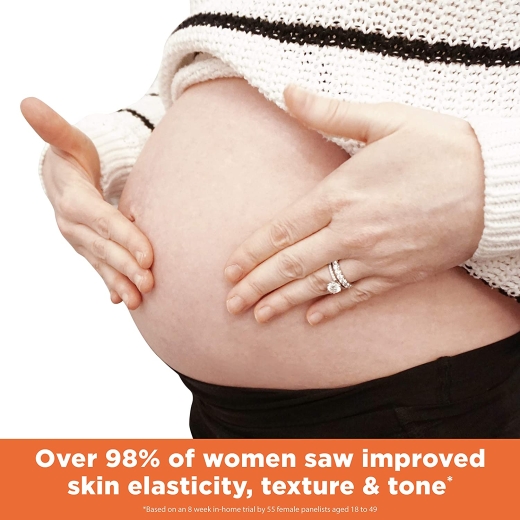 زبدة الكاكاو  لعلامات التمدد -من بالميرز