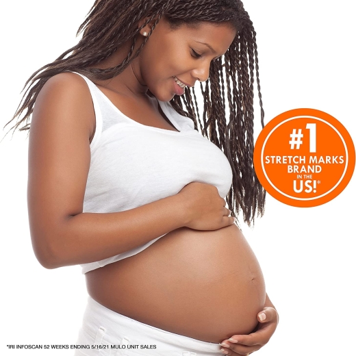 زبدة الكاكاو  لعلامات التمدد -من بالميرز