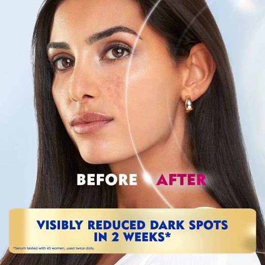 سيروم مضاد للتصبغات مفتح  لومينوس 630- من نيفيا