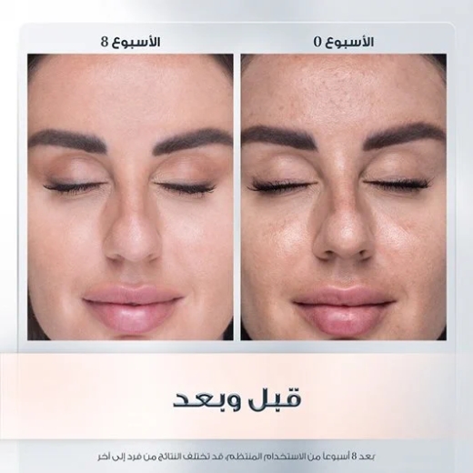 كريم النهار المضاد للتصبغ معا 30% حماية من اشعة الشمس من يوسرين