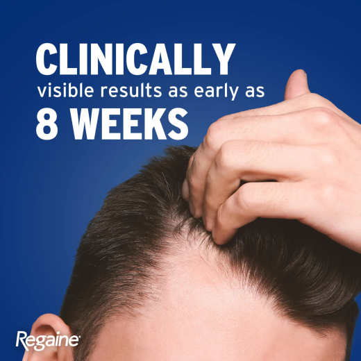 مينوكسيديل 5% رغوة لعلاج تساقط الشعر - من ريجين