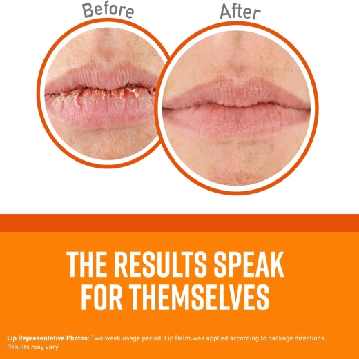 مرطب شفاة مرمم للشفاة المتشققه غير معطر - من اوكيفس