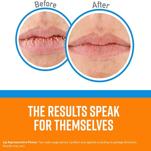 مرطب شفاة انتعاش مرمم ومرطب - من اوكيفس