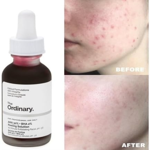 مقشر احماض الفواكه - من ذا اورديناري