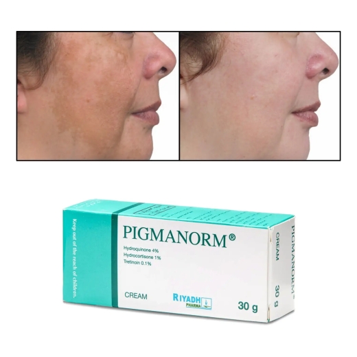 كريم بيجمانورم