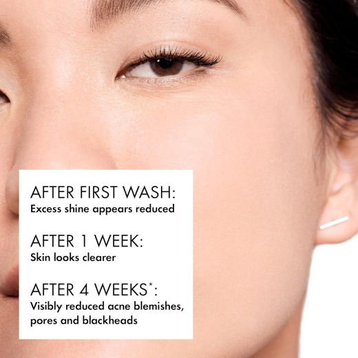 غسول الوجه اليومي بحمض الساليسيليك  للبشرة الدهنية والمعرضة للبثور- من فيشي