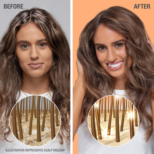 شامبو مقشر  لفروة الرأس والتألق للشعر الدهني- من  نيتروجينا