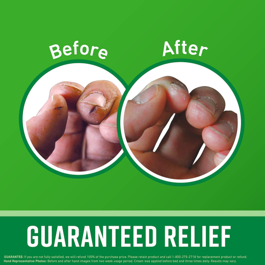 كريم اليدين ترطيب البشرة المتشققه ووركينج هاندس من اوكيفيز