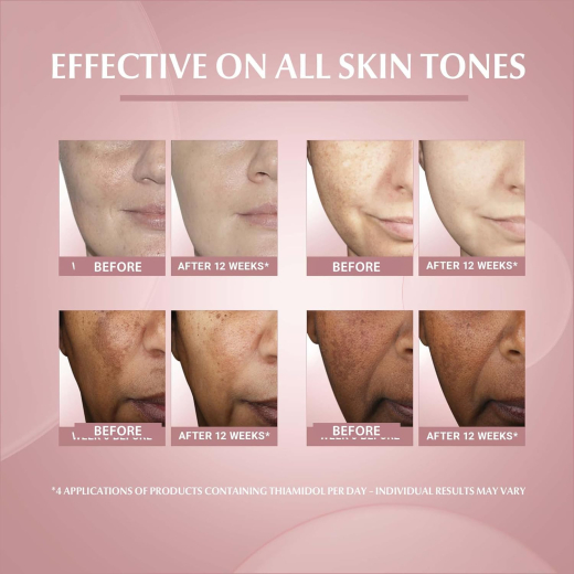 سيروم التتصبغات ايفن بيجمنت سكين بيرفكتنج من يوسرين