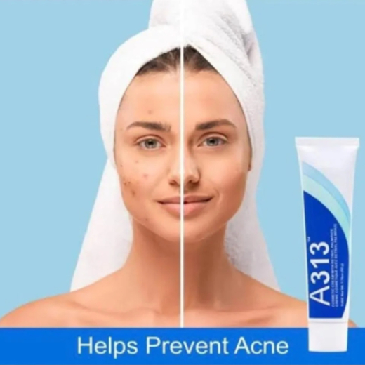 كريم A313 ريتينول المرطب لتفتيح البشرة بفيتامين أ