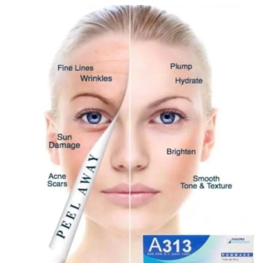 كريم A313 ريتينول المرطب لتفتيح البشرة بفيتامين أ