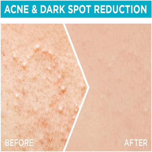 سيروم فاست كلير بوستر سكين اكتيف للوجه  معزز بحمض الساليسيليك للبشرة المعرضة لحب الشباب - من غارنييه