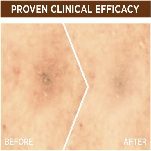 سيروم فيتامين سي 10% سكين أكتيف الليلي  - من غارنييه
